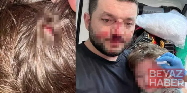 Kucağındaki bebeğiyle birlikte darbedilen baba: Odunla vurdu, kızım çırpınırken tekrar vurdu