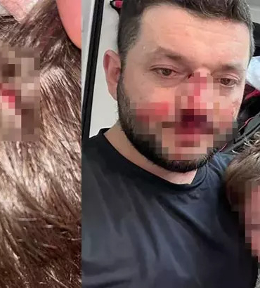 Kucağındaki bebeğiyle birlikte darbedilen baba: Odunla vurdu, kızım çırpınırken tekrar vurdu