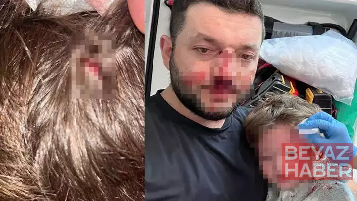 Kucağındaki bebeğiyle birlikte darbedilen baba: Odunla vurdu, kızım çırpınırken tekrar vurdu