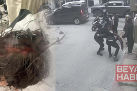 Yolda yürürken ölümden döndü: Kafasına 7 dikiş atıldı