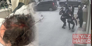 Yolda yürürken ölümden döndü: Kafasına 7 dikiş atıldı