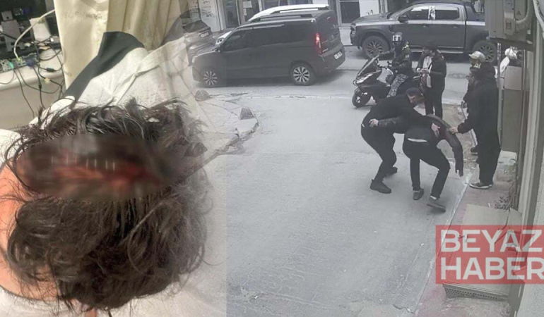 Yolda yürürken ölümden döndü: Kafasına 7 dikiş atıldı