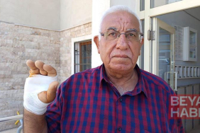 Komşusunun ısırdığı parmağı ampute edildi