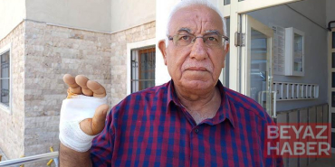 Komşusunun ısırdığı parmağı ampute edildi
