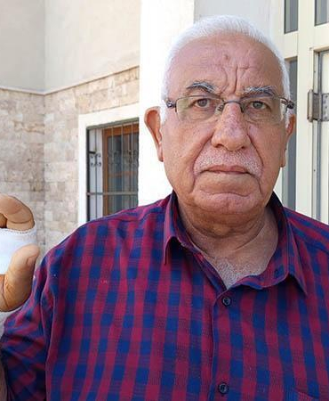 Komşusunun ısırdığı parmağı ampute edildi