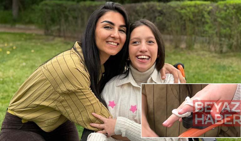 Bahar, annesinin geliştirdiği aparatla elini kullanmaya başladı
