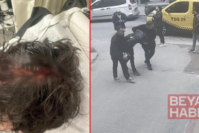 Beyoğlu’nda kaldırımda yürürken başına cam düştü; 7 dikiş atıldı