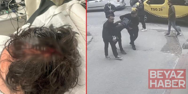 Beyoğlu’nda kaldırımda yürürken başına cam düştü; 7 dikiş atıldı