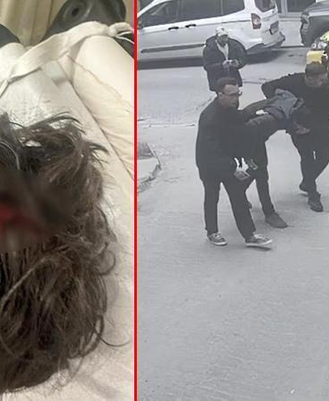 Beyoğlu’nda kaldırımda yürürken başına cam düştü; 7 dikiş atıldı
