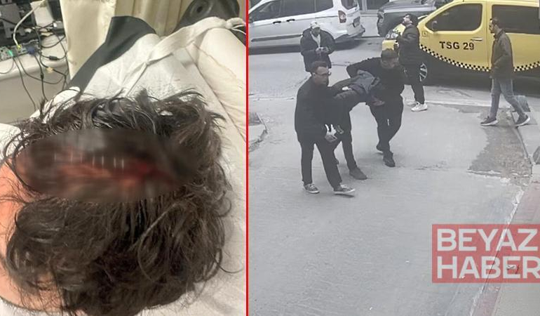 Beyoğlu’nda kaldırımda yürürken başına cam düştü; 7 dikiş atıldı