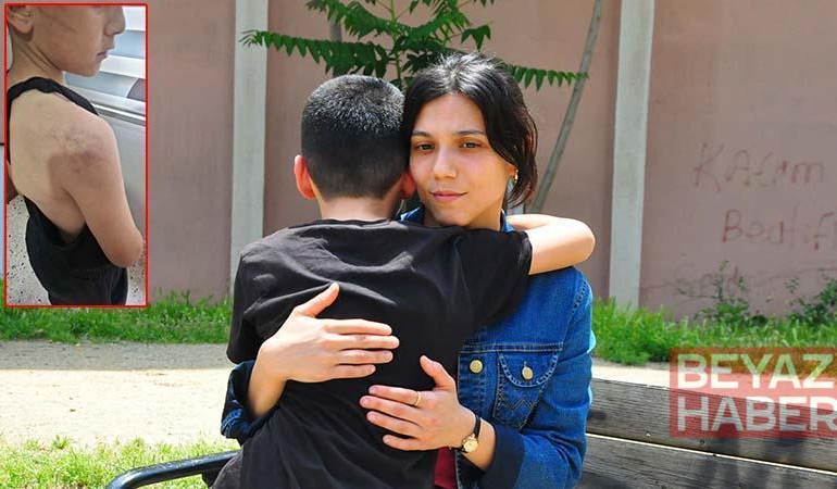 Babasının darbettiği 12 yaşındaki çocuk koruma altına alındı