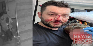 Kucağında bebeği olan babayı darbeden şüpheli adli kontrolle tahliye edildi