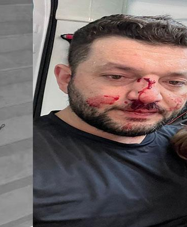 Kucağında bebeği olan babayı darbeden şüpheli adli kontrolle tahliye edildi
