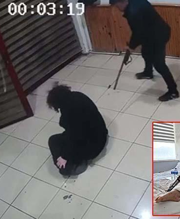 Boşanma aşamasındaki eşini bacaklarından vuran sanık: İçeride ne oldu, hatırlamıyorum