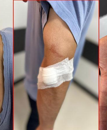 İlaç raporu tartışmasında tıbbi sekreteri darbetti