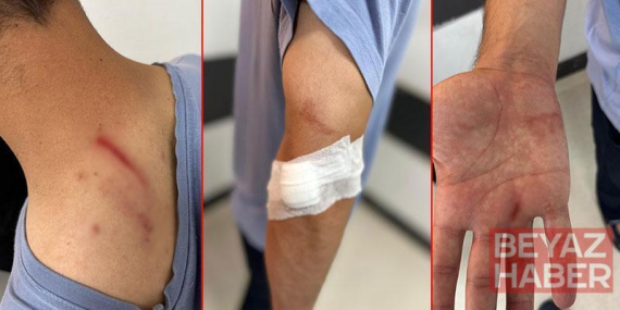 İlaç raporu tartışmasında tıbbi sekreteri darbetti