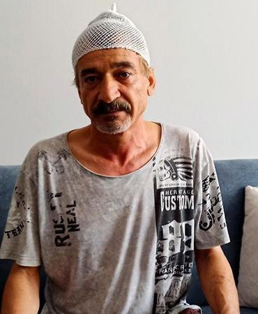 Çay içerken başına beton parçası düştü