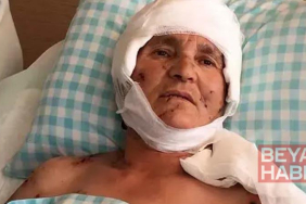Köpek saldırısında yaralanan kadına 637 bin lira tazminat kararı