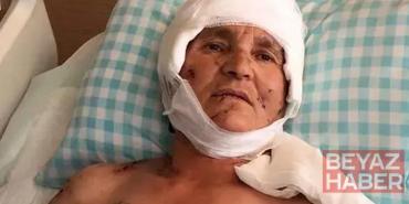 Köpek saldırısında yaralanan kadına 637 bin lira tazminat kararı