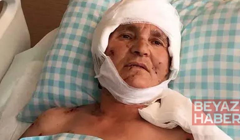 Köpek saldırısında yaralanan kadına 637 bin lira tazminat kararı