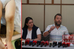 Kreşte 2 yaşındaki çocuğa darp iddiasına takipsizlik kararı