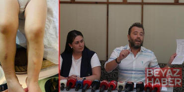 Kreşte 2 yaşındaki çocuğa darp iddiasına takipsizlik kararı