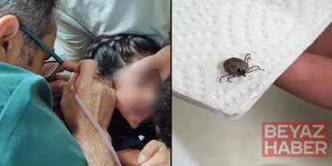 Çocuğun kulağından canlı kene çıkarıldı