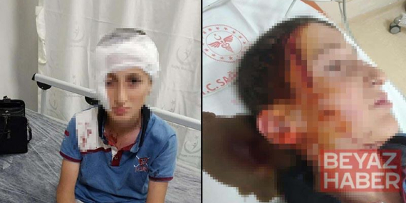 11 yaşındaki çocuğa köpek saldırısında 1,2 milyon TL tazminat kararı
