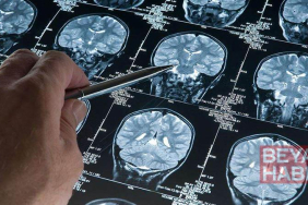 Araştırma: Derin uyku Alzheimer’ı yavaşlatıyor