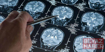 Araştırma: Derin uyku Alzheimer’ı yavaşlatıyor