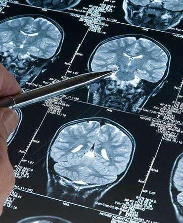 Araştırma: Derin uyku Alzheimer’ı yavaşlatıyor