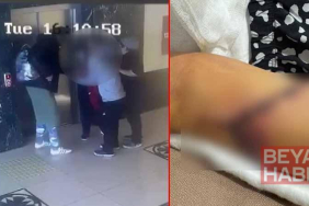 Özel okulda öğrencinin koluna kapı kolu saplandı, soruşturma başlatıldı