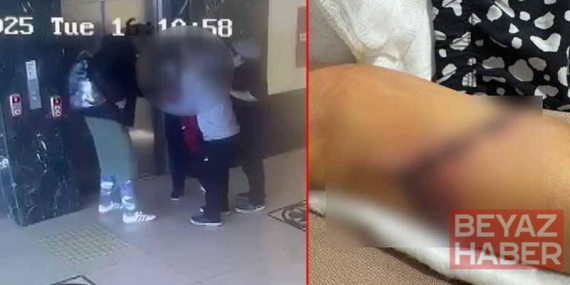 Özel okulda öğrencinin koluna kapı kolu saplandı, soruşturma başlatıldı