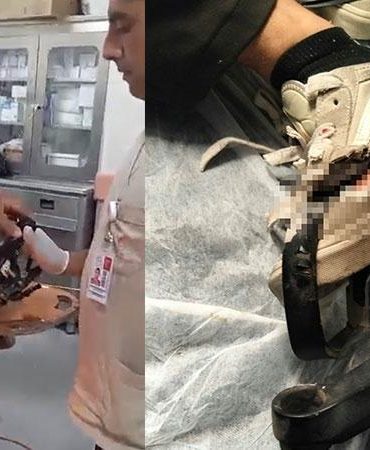 Kazada motosiklet sürücüsünün ayağına demir parçası saplandı