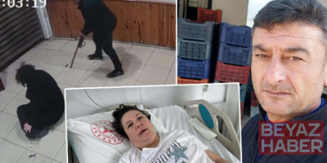 Boşanma aşamasındaki eşi tarafından vuruldu, bacakları ampute edildi! 'Pes' dedirten savunma: Sevdiğim için oldu