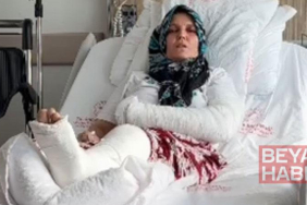 Kavgada 3 çocuk annesinin kolu ve bacağı kırıldı