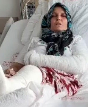 Kavgada 3 çocuk annesinin kolu ve bacağı kırıldı