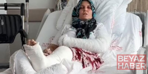 Kavgada 3 çocuk annesinin kolu ve bacağı kırıldı