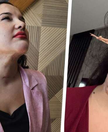 Yaptırdığı işlem sonrası yoğun bakıma kaldırıldı: 5 milyonluk dava açtı