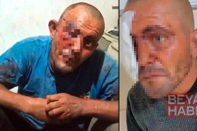 Sanal medyadaki videoları ile tanınan zihinsel engelli darbedildi