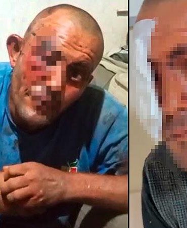 Sanal medyadaki videoları ile tanınan zihinsel engelli darbedildi