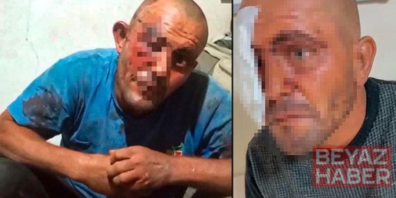 Sanal medyadaki videoları ile tanınan zihinsel engelli darbedildi