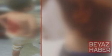 Arnavutköy’de arkadaşları tarafından kolonya dökülüp ateşe verilen 12 yaşındaki çocuk yaralandı