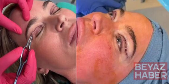 4. evre kanser tedavisi görürken estetik yaptırdı: Doktorlarım onay verdi