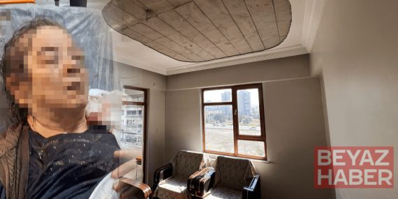 Evinin salonunda otururken kabusu yaşadı: Bir gözünü kaybetti, burnu kırıldı