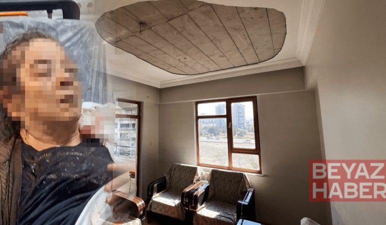 Evinin salonunda otururken kabusu yaşadı: Bir gözünü kaybetti, burnu kırıldı